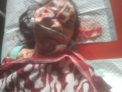 Pelaku Penganiayaan Nenek Lansia di Besuki Masih Buron, Warga Trauma dan Desak Polisi Bertindak Cepat